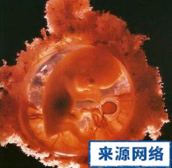 孕妇的肚型 生男生女 胎心 胎儿